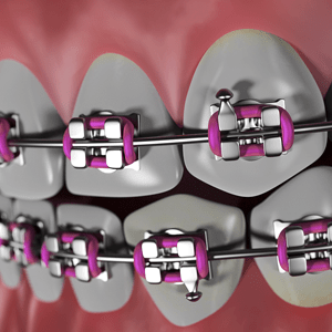 Braces from an orthodontist in Cary NC